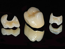 ceramic teeth