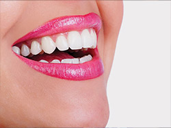 a perfect smile following a visit to the dental hygienist in sidcup