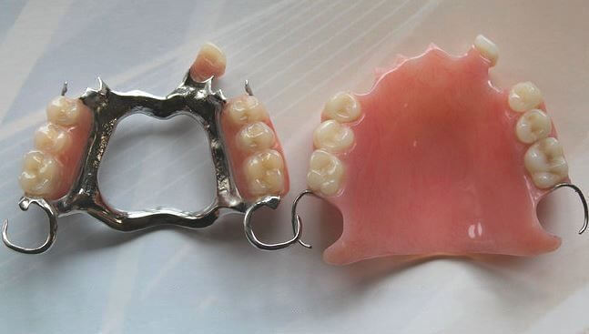 A Cobalt chrome denture   and an acrylic denture
