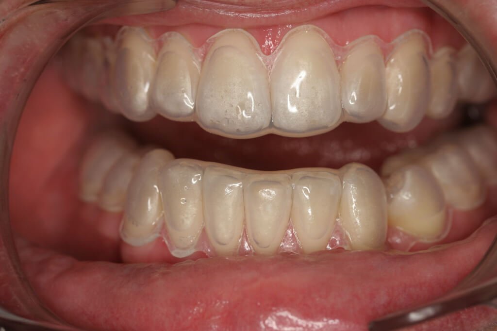 Dentist Sidcup Cosmetic Dentist Birkbeck Dentistry