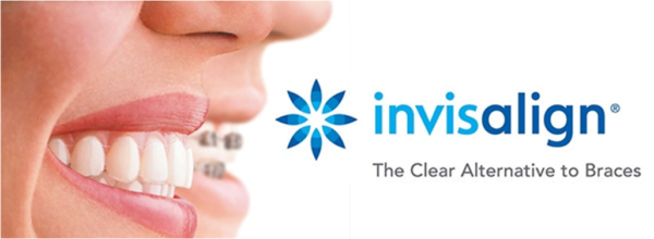 invisalign braces in comparison to traditional braces